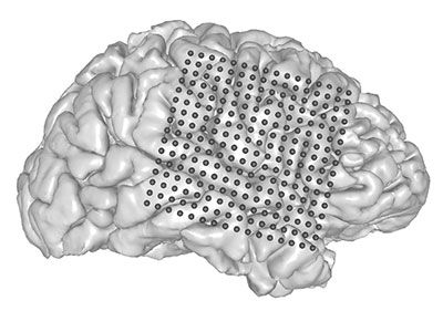 Brain implants that let you speak your mind